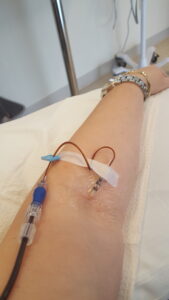 An arm with a line in it receiving an infusion in a medical setting